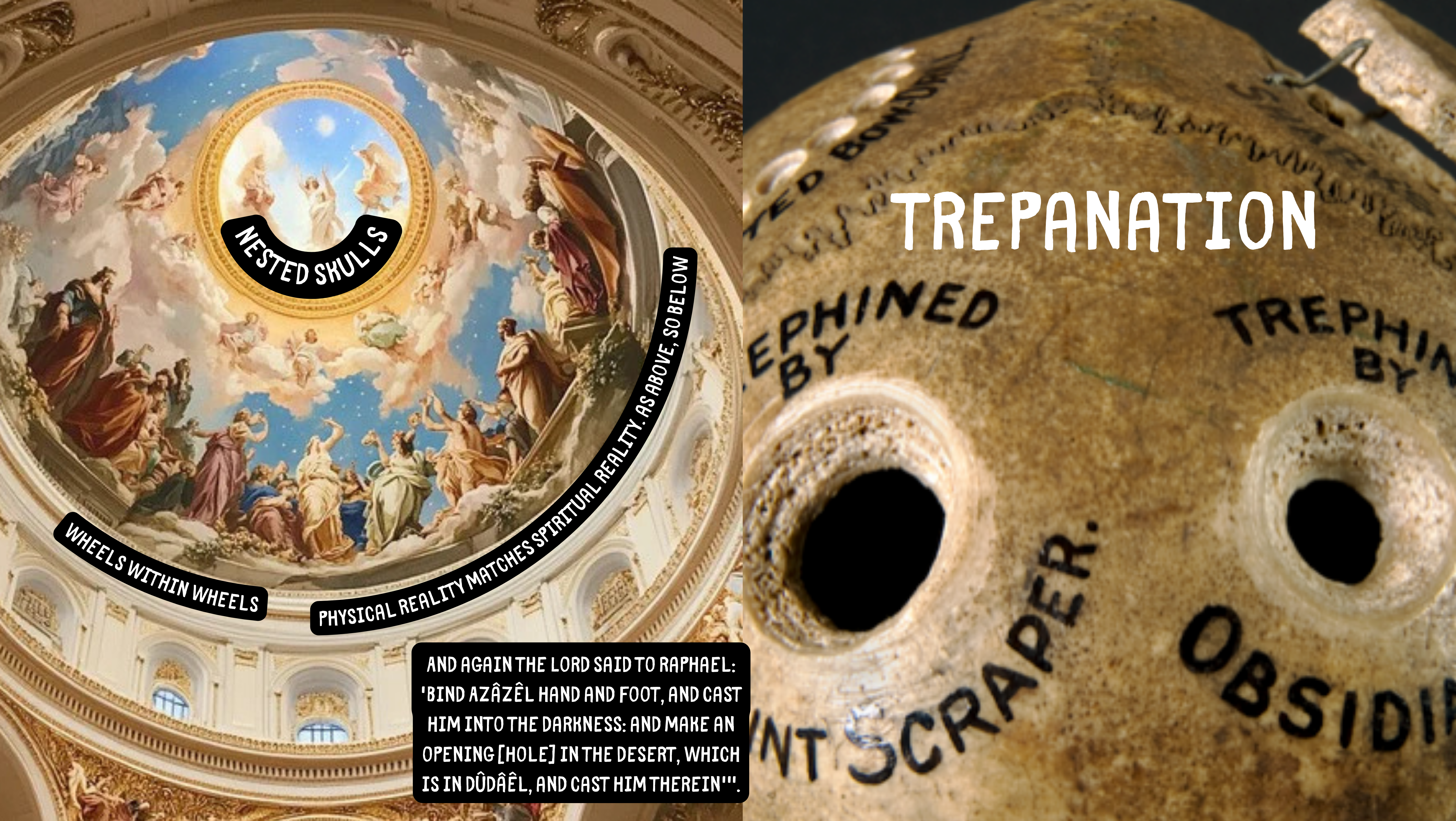 trepanation too